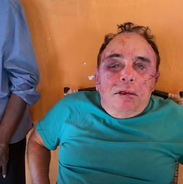 Vídeo: Bandidos invadem fazenda de candidato a prefeito de Santa Terezinha, Arimateia Camboim, e causam verdadeiro terror