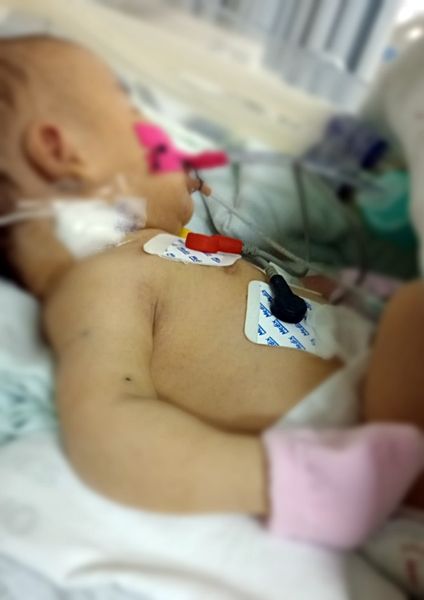 Pai de bebê que sofreu negligência médica na Maternidade de Patos faz campanha por ajuda financeira após transferência para João Pessoa; Veja como ajudar