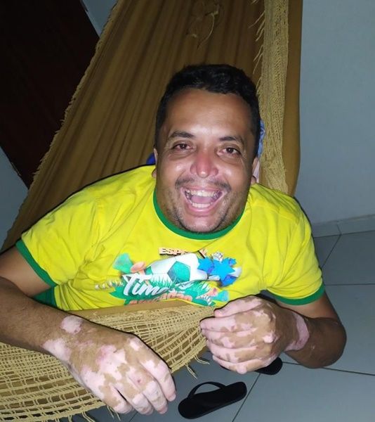 Morre Ivanildo Rodrigues, irmão da vice-prefeita de Santa Terezinha por complicações da Covid-19