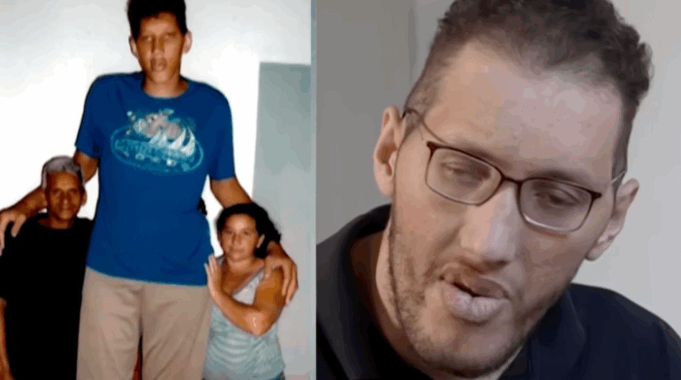 Ninão, o homem mais alto do Brasil, enfrenta nova batalha e corre o risco de amputar também a perna esquerda