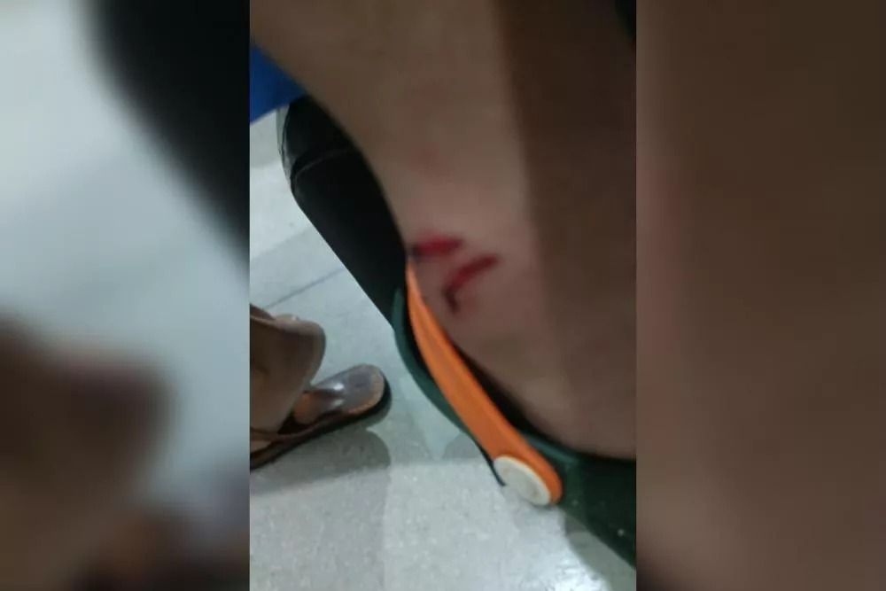 Até quando? Cães atacam criança de 3 anos em Patos, que fica ferida e é levada ao hospital; veja