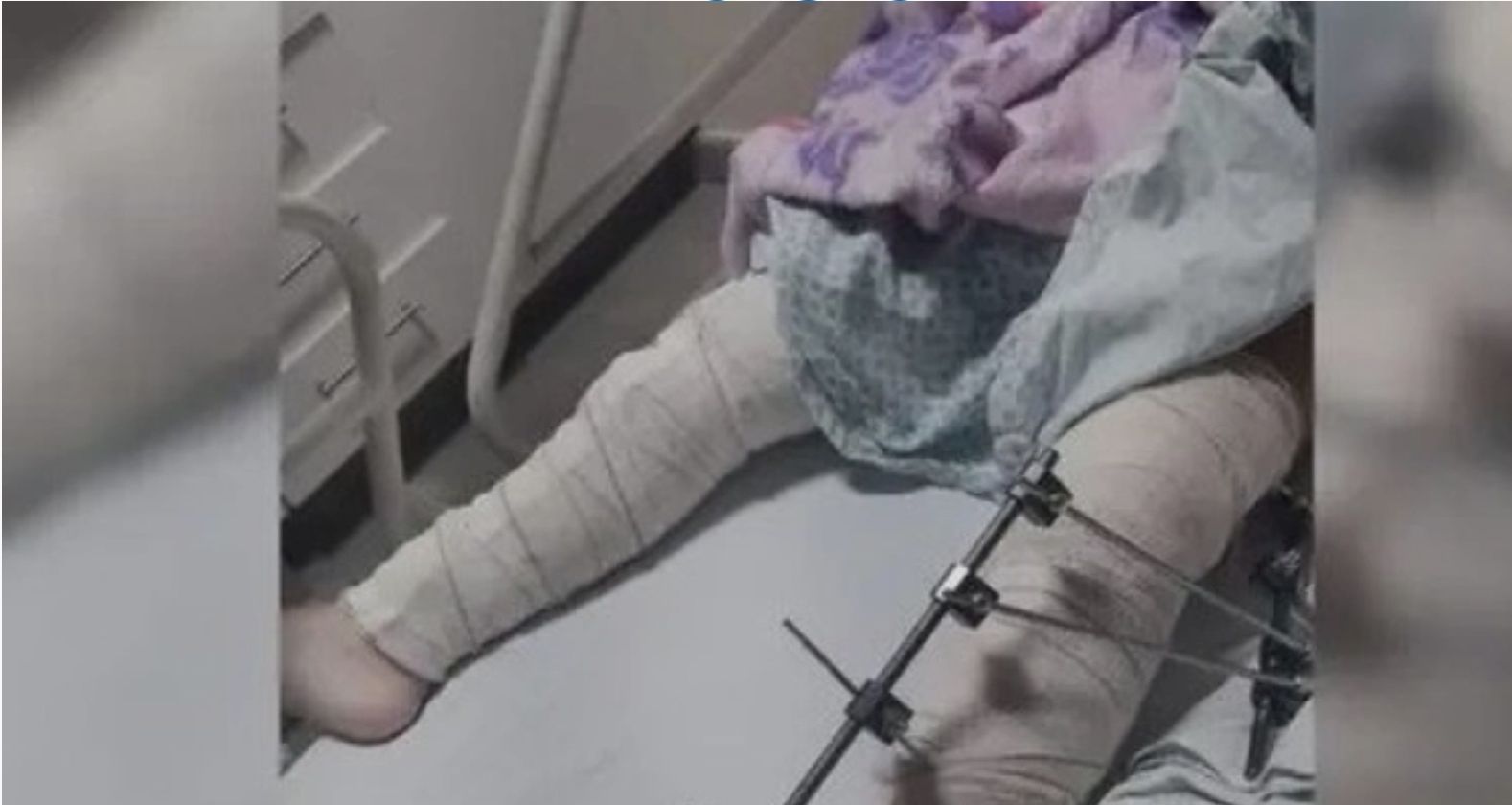 Erro grave: Equipe médica é afastada após erro em cirurgia de criança no Hospital de Trauma em Campina Grande