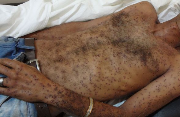 Homem é atacado por enxame de abelhas e sofre mais de 200 ferroadas, em Conceição